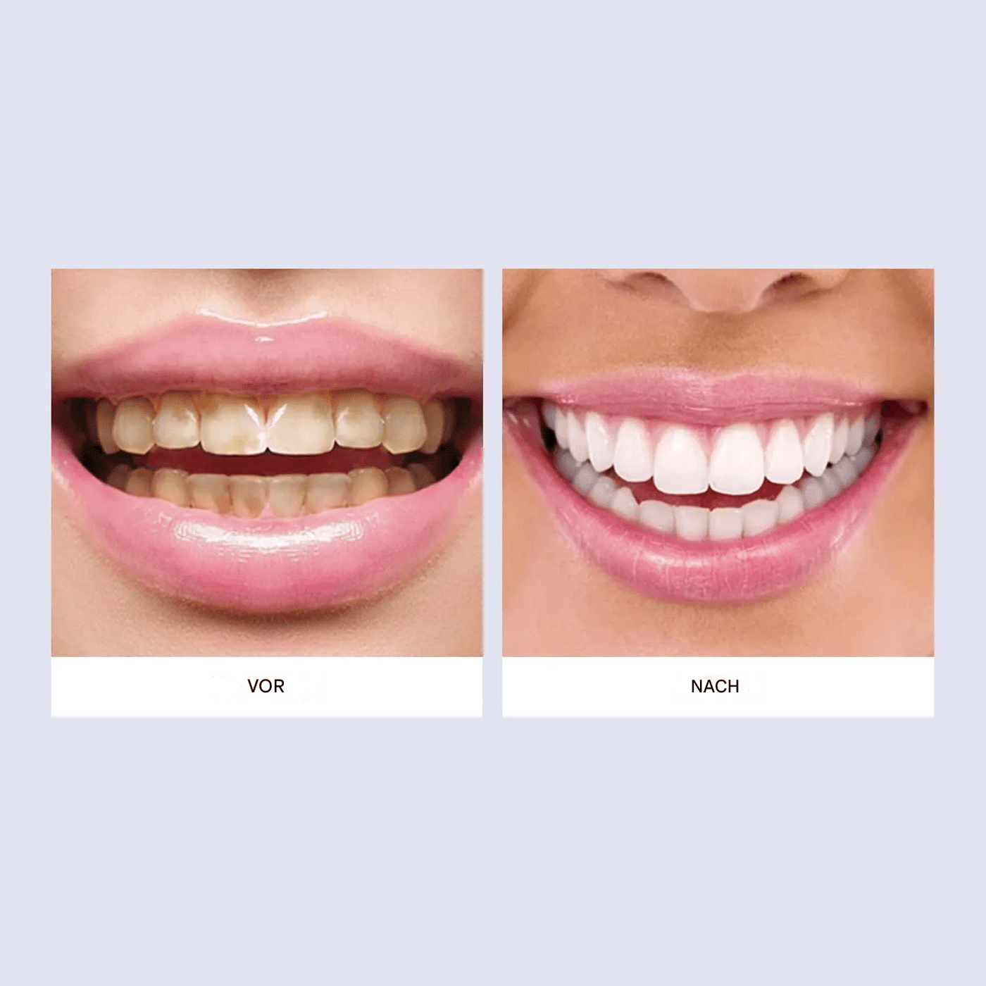 Hydroxyapatite Zahnpasta