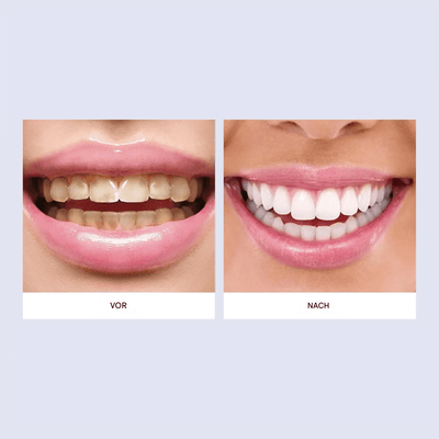 Hydroxyapatite Zahnpasta